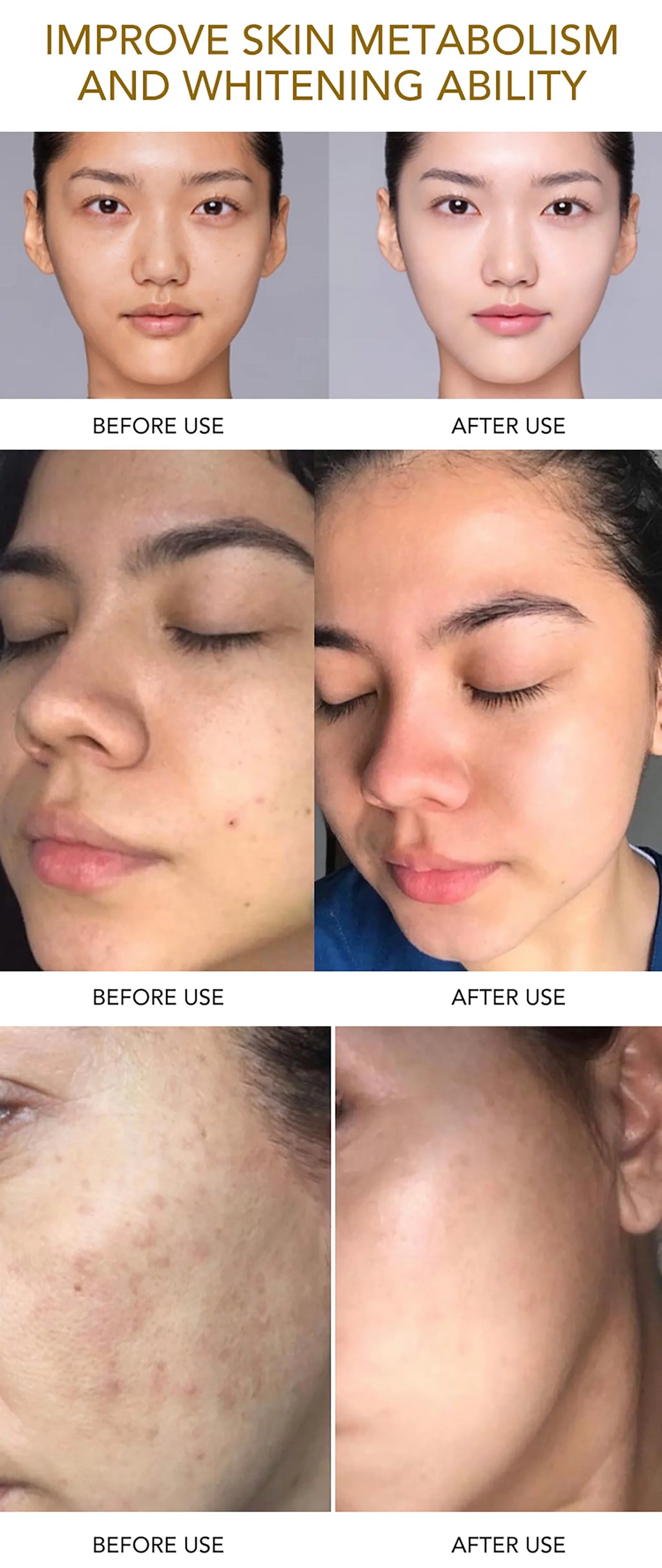 AILKE Brightening Skin Care Set – Even Skin Tone, Anti-Wrinkle & Dark Spot Corrector for All Skin Types